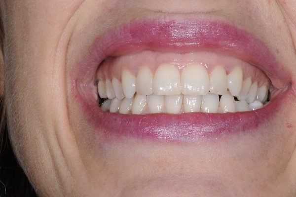 Before Image